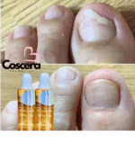 NT Nail Fungus Serum 15ml – Intensive Repair & Protection Formula - Image 2