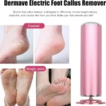 Professional Electric Foot Callus Remover - 3000RPM Pedi File - Image 2